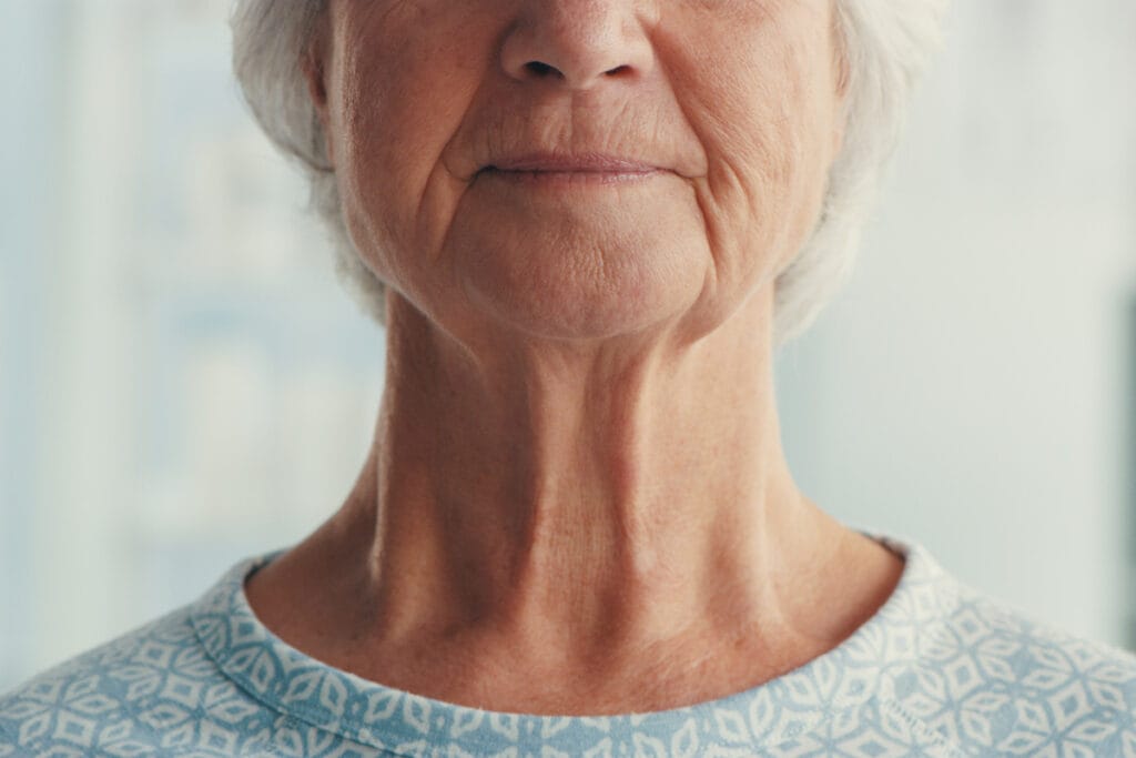 Close up of faceless mature woman with neck bands due to neck aging